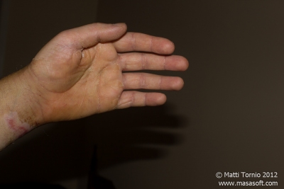 Hand